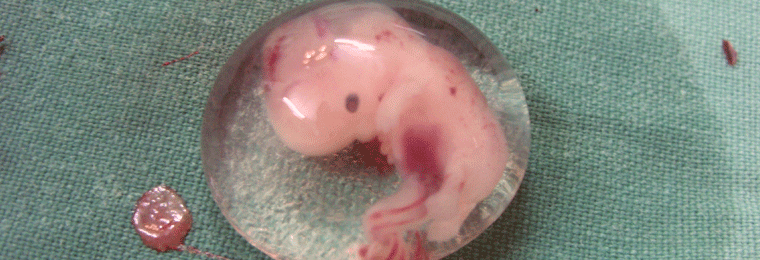 EŽTT pritarė Italijos draudimui naudoti embrionus mokslui