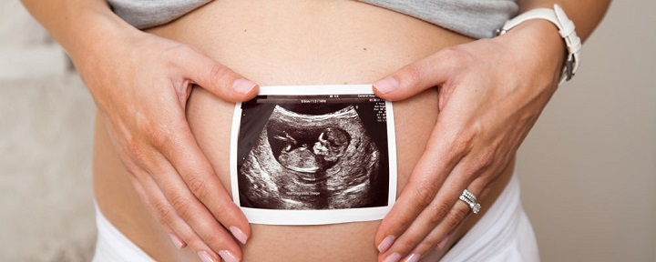 Abortas negali būti „pagrindinė žmogaus teisė“ ar „laisvė“
