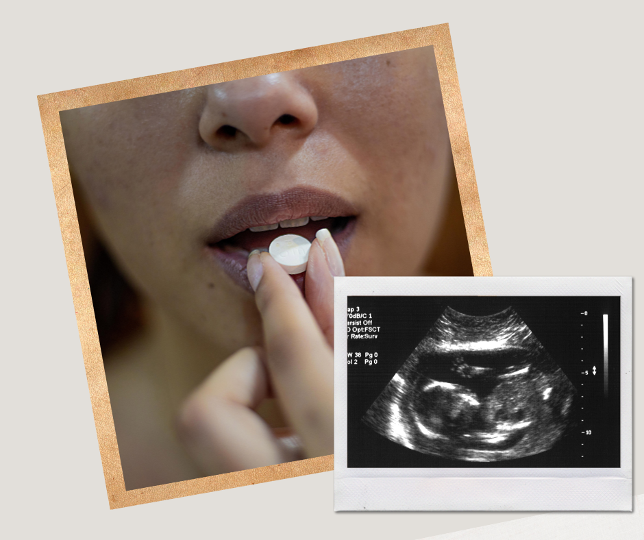 Diana Karvelienė: ekspertai kelia klausimus dėl medikamentinio aborto. Ar tai – vaistai be žalos?
